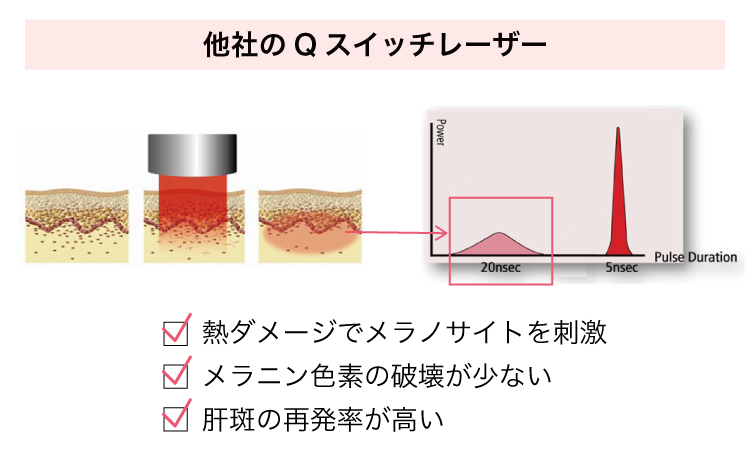 他社のQスイッチレーザー