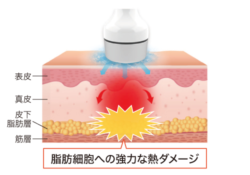 リヴァイブのマイクロ波の特徴