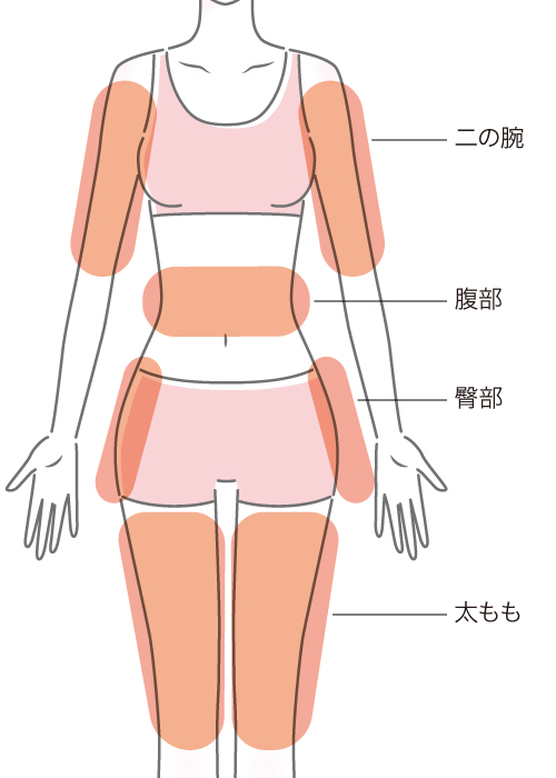 リヴァイブボディの施術可能部位