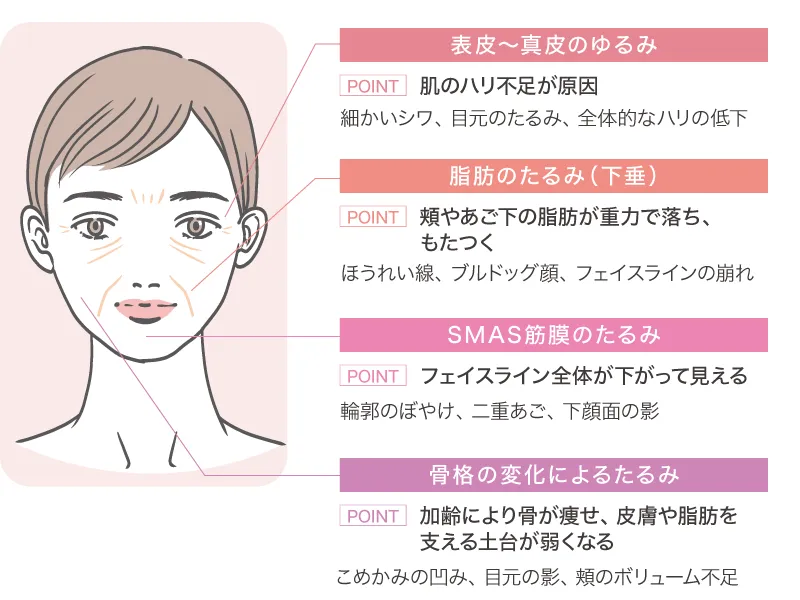 たるみの種類