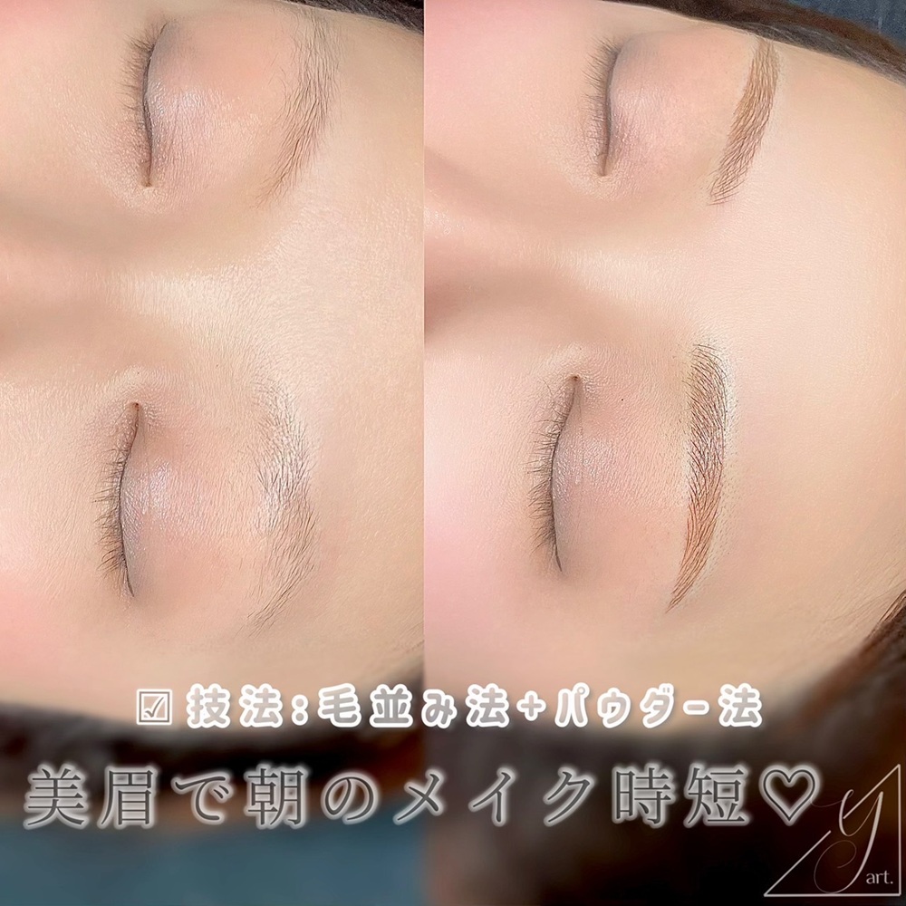 アートメイク眉 症例写真